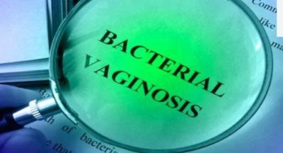 Home Remedies for Bacterial Vaginosis